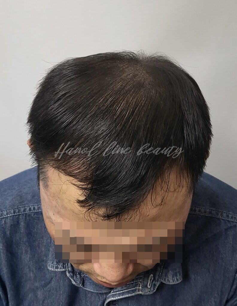 머리문신
