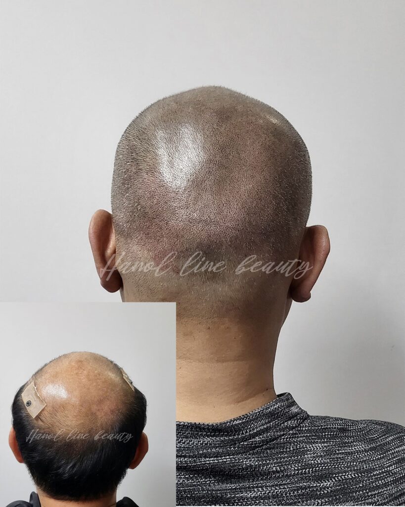 가르마문신