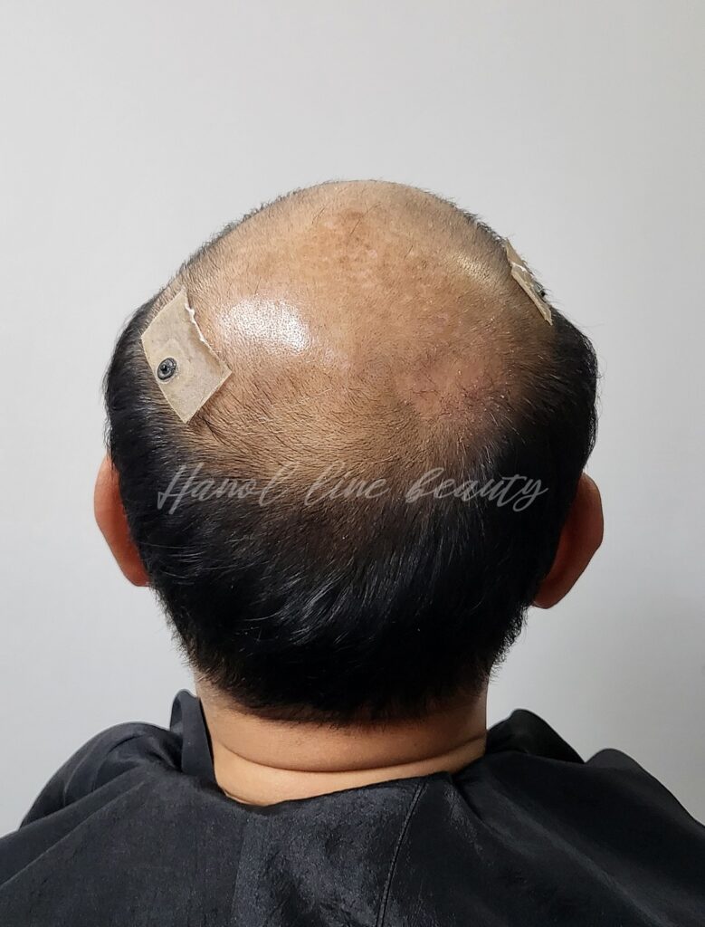 삭발문신